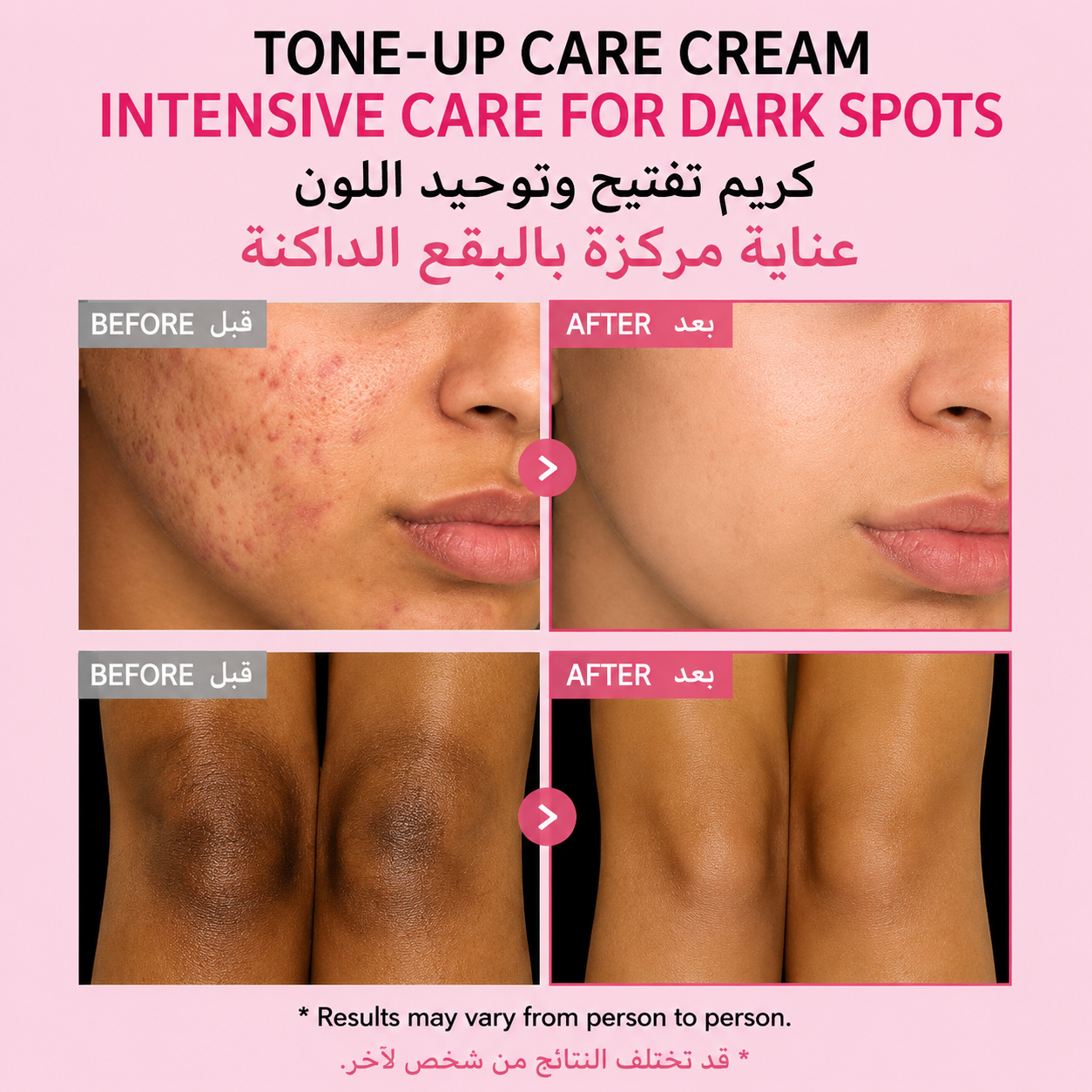 TOSOWOONG Dark Spot 35 Fade Cream | Albutin | Kojic Acid | Niacinamide |Panthenol Underams | Bikini Line | Knees | Elbows | Dark Areas | 50ml