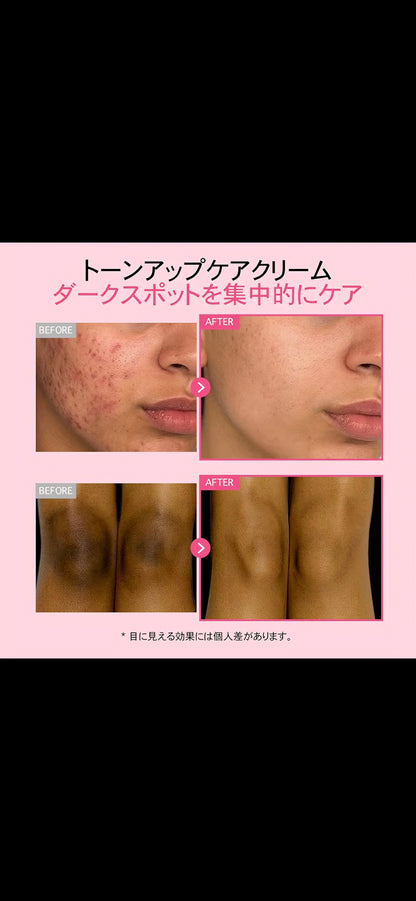 TOSOWOONG Dark Spot 35 Fade Cream | Albutin | Kojic Acid | Niacinamide |Panthenol Underams | Bikini Line | Knees | Elbows | Dark Areas | 50ml